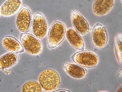 🔬 DINOFLAGELADOS EN ACUARIOS MARINOS: Qué Son, Por Qué Aparecen, Cómo Erradicarlos y Mitos – Guía Científica Completa (2026)